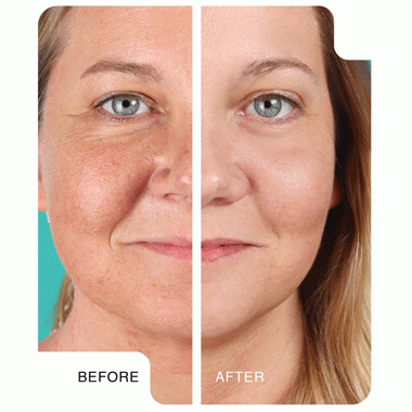 DermatudeForweb