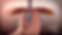 Device-inside-with-endoscope-800px (002).png