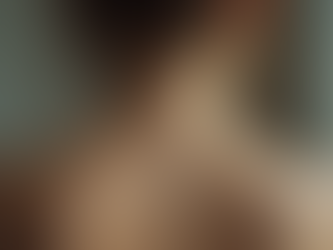 Cupping Therapy: Understanding the Marks