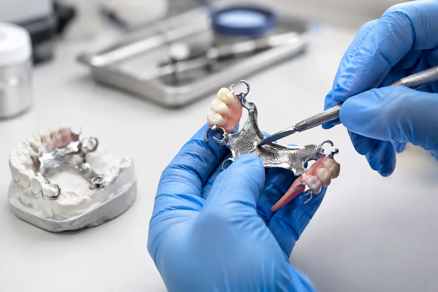 How to Repair Denture Metal Framework Safely