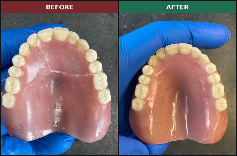 Before and after: crack through an upper denture palate, repaired at our lab for a patient south of Boston