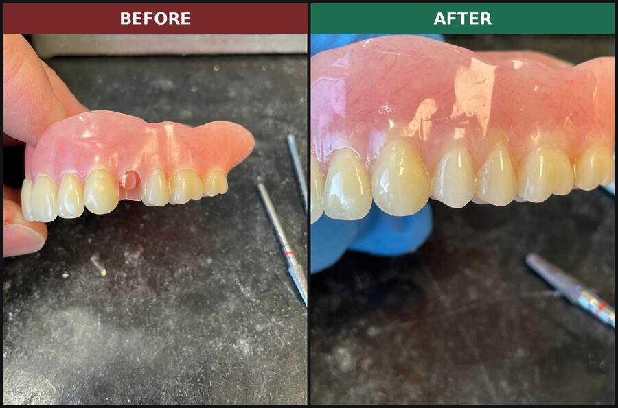 Before and after: missing denture tooth replaced at our Massachusetts denture repair lab