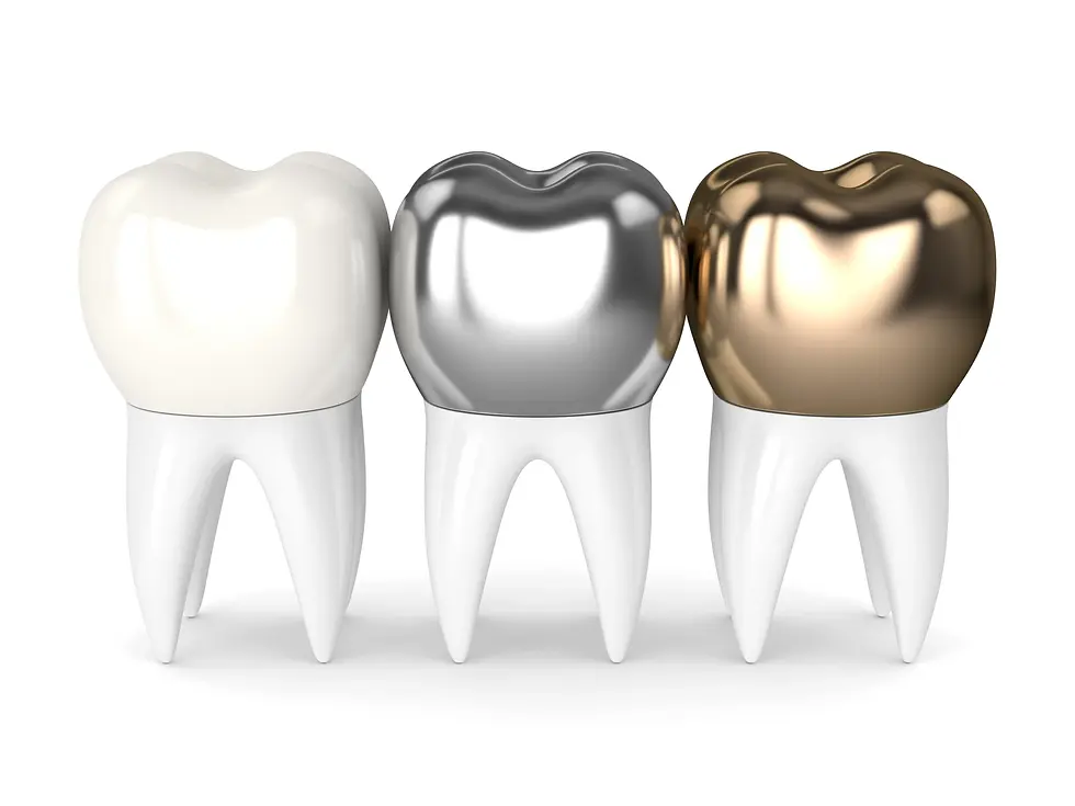 dental crowns
