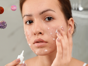 Acne, the Skin Microbiome, and Antibiotic Treatment 