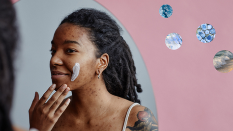 Formulating for Results: The Key Actives Behind Effective Acne Care