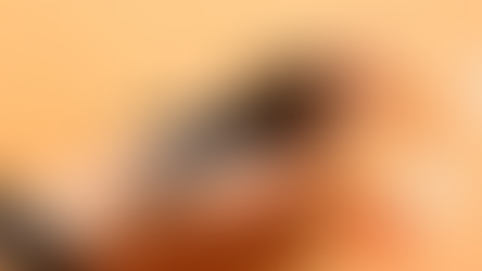 Cancer's Silent Associate? What is the Skin Microbiome's Role in Cancer Progression and Treatment