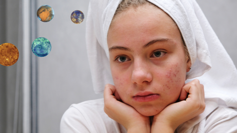 Why is my skin reacting to everything all of a sudden?