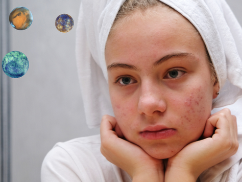 Why is my skin reacting to everything all of a sudden?
