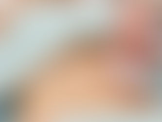 ماذا أتوقع خلال أول استشارة لشفط الدهون بالليزر؟