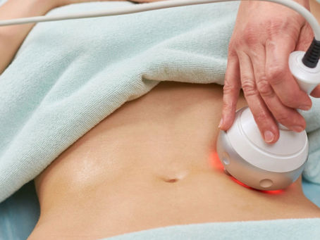 ماذا أتوقع خلال أول استشارة لشفط الدهون بالليزر؟