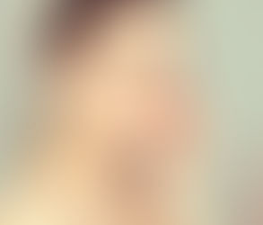 What Should I Avoid After Getting Laser Skin Tightening in Dubai?