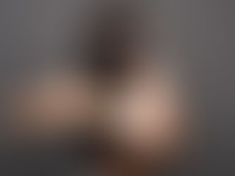 Does Wearing Hijab or Headgear Lead to Hair Thinning in Dubai?