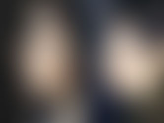 Can Rhinoplasty in Dubai Correct a Bulbous Nose Tip?