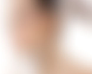 How often should I get touch-ups for dermal fillers in Dubai?