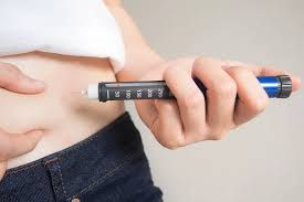 How Painful Are Mongaro Injections, and Is There Any Downtime?