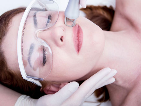 What Should I Avoid Before and After Facial Laser in Dubai?