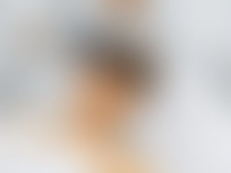 Can laser therapy reduce fine lines around my eyes?