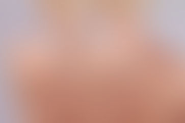 Can I Remove a Tattoo Over a Scar with Laser in Dubai?