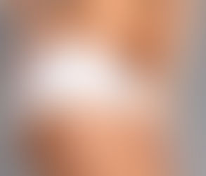 Are the Results of Vaser Liposuction in Dubai Truly Natural-Looking?