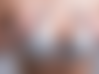 Can a Non-Surgical Breast Lift Help Correct Uneven Breasts?