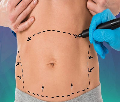How do Vaser and laser liposuction differ in Dubai?