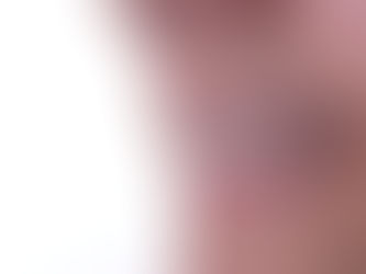 How many trips do I need for veneers ?