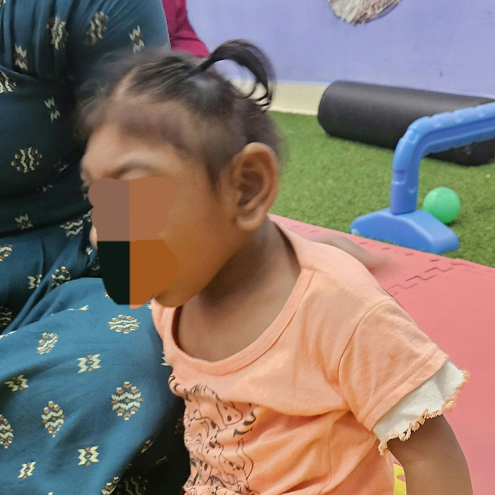 What is Microcephaly ?