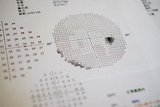 眼科健診(緑内障健診、VDT健診)