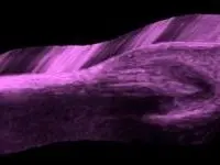 TOP TEN REASONS TO ORDER OR PERFORM ULTRASOUND IN DERMATOLOGY