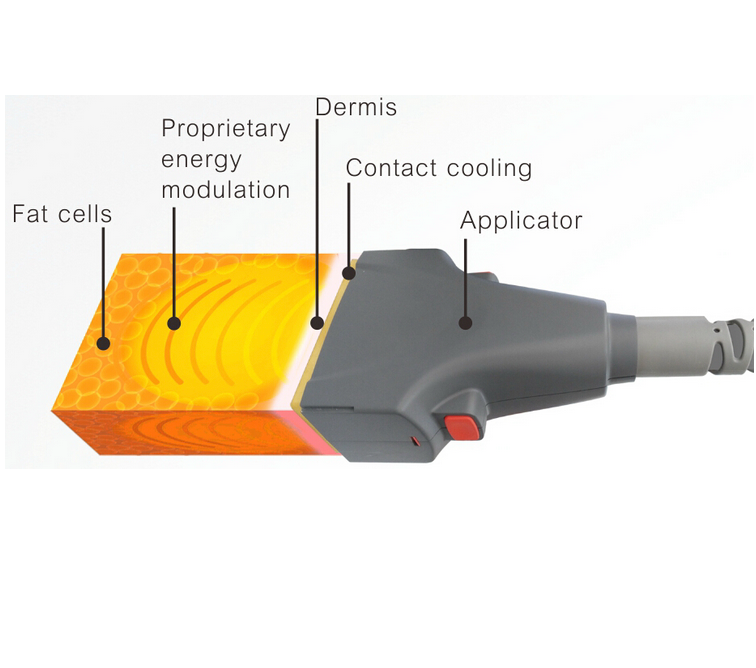 Thumbnail: Non-Surgical Laser Body Sculpting Machine