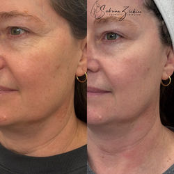 eZy Watermark_12-03-2026_18-51-02-8630