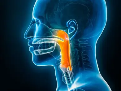 LES CAUSES PROFONDES DU REFLUX LARYNGO-PHARYNGÉ (REFLUX ORL)