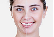 A woman's face is shown in two different images, one with wrinkles and one without wrinkles, to show the effects of aging.