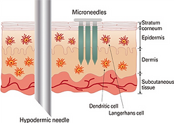 microneedle.png