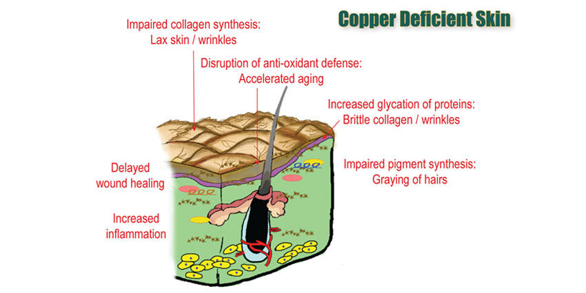 Copper_chaptergraphic1_copperdeficiency.jpg