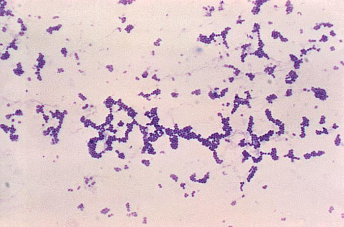 A Gram-stained microscopic picture of Staphylococcus aureus