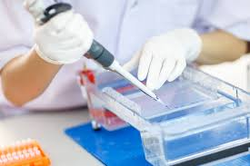 Western Blotting: Its Application and Importance!