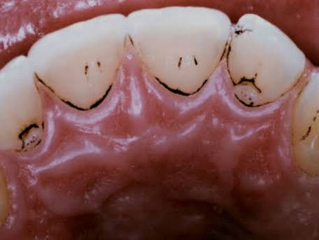 Bactérias Cromogênicas, sabe o que fazem?