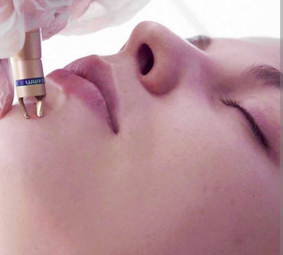 thread veins 980nm.jpg