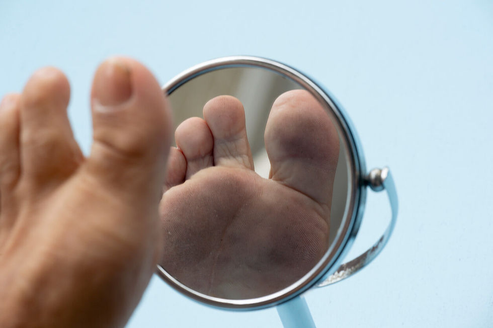Person with diabetes checking feet daily for cuts or redness