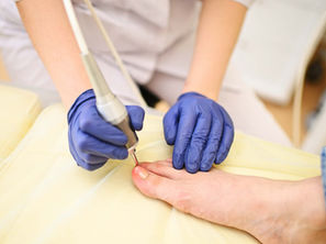 Laser Ingrown Toenail Surgery Recovery: Timeline & Aftercare in Phoenix