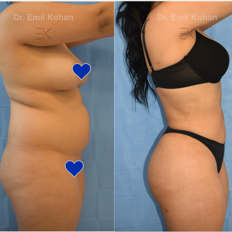 Body Transformation