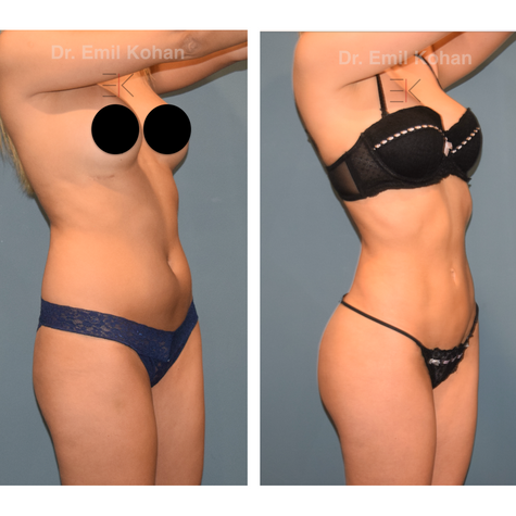 Body Transformation