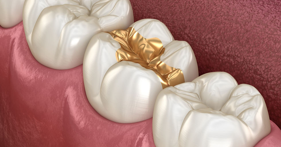 Dental-fillings-G.jpg