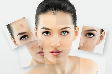 facial treatment