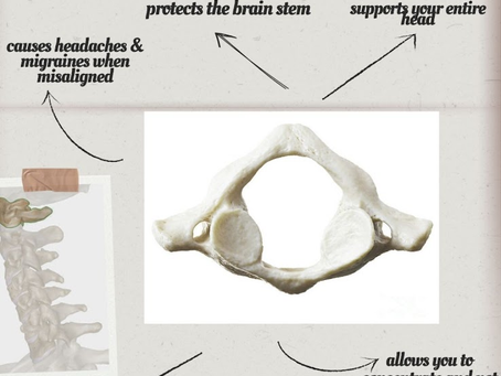 Why Your Headaches Keep Coming Back (And It Might Not Be Your Head)