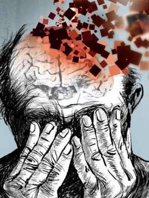 Understanding Dementia to the Next Level: symptoms, types, medication