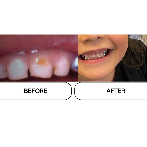 Beige Minimalist Skincare Before and After Instagram Post (11).png