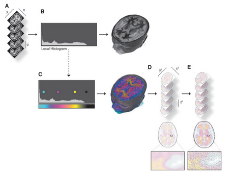 Advancing Surgical Precision: A Deep Dive into Soft Tissue Bitmap Printing for Surgical Planning