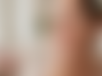 Laser Hair Removal and PCOS: What Women With Hormonal Hair Growth Should Know